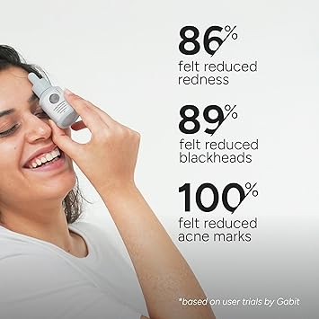 Gabit 5% Azelaic Acid Face Serum For Acne, Blackheads, Open Pores & Spots| Salicylic (1%),Hyaluronic,Green Tea,Prebiotic,Probiotic|For Oily,Acne Prone Skin|Oil & Fragrance free|For Women & Men,30 ml - Image 4