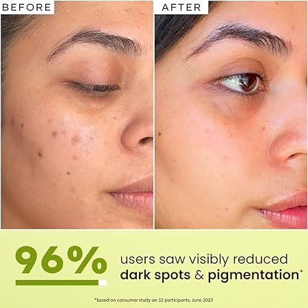 Hyphen Brightening 5% Niacinamide, 1% Alpha Arbutin Face Serum | With 25% Kakadu Plum -20X More Vitamin C Serum for Glowing Skin | 56% Glow Actives for Dark Spots & Pigmentation | All Skin Types -30ml - Image 4